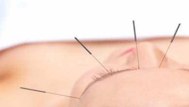 Migren İçin Akupunktur Tedavisi Mümkün Mü?